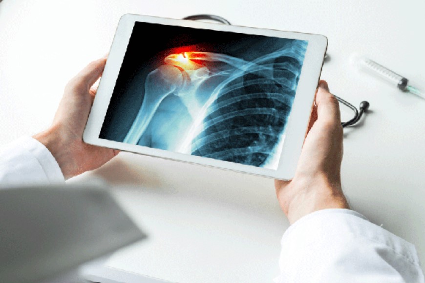 shoulder xray homevisit