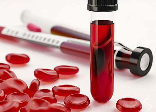 غربالگری چکاپ پیشگیری درمنزل آرامیس تهران